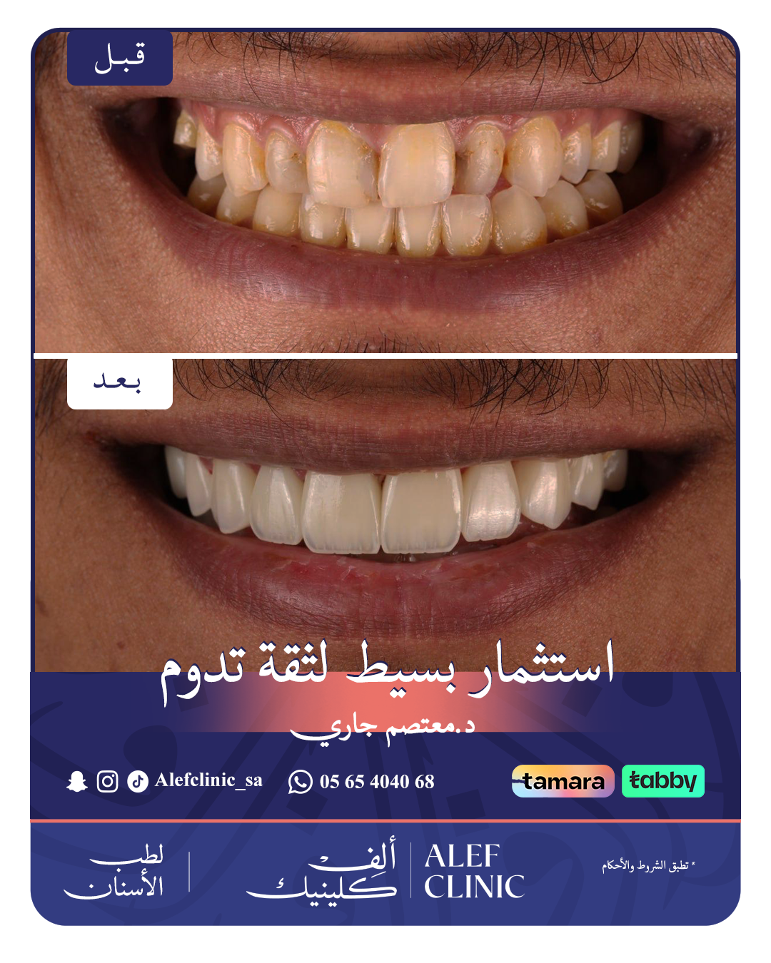 قبل وبعد