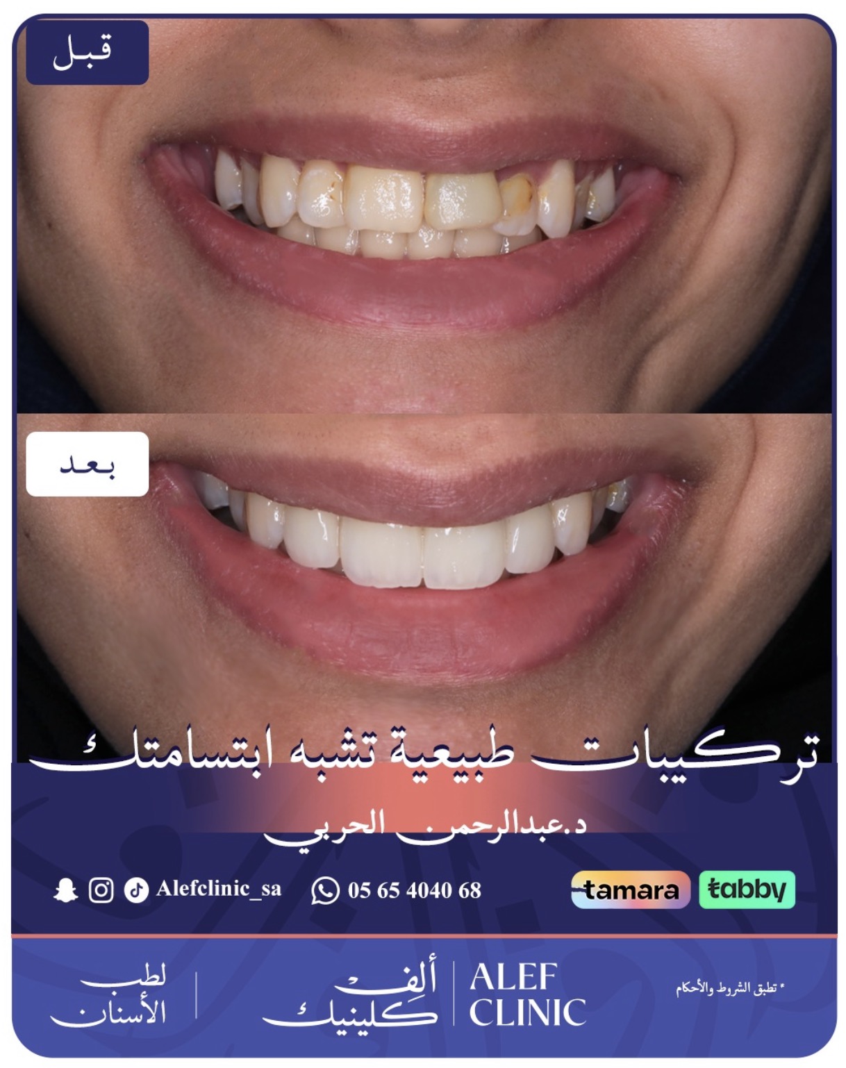 قبل وبعد