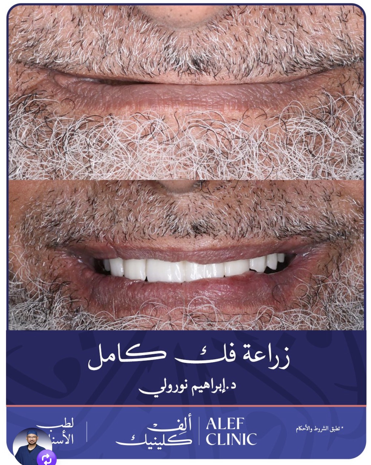 قبل وبعد