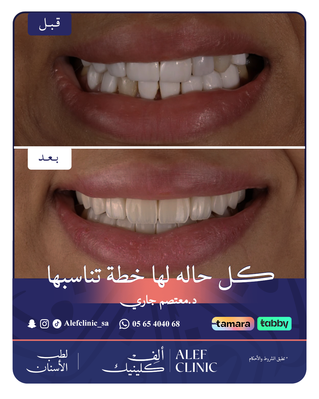 قبل وبعد