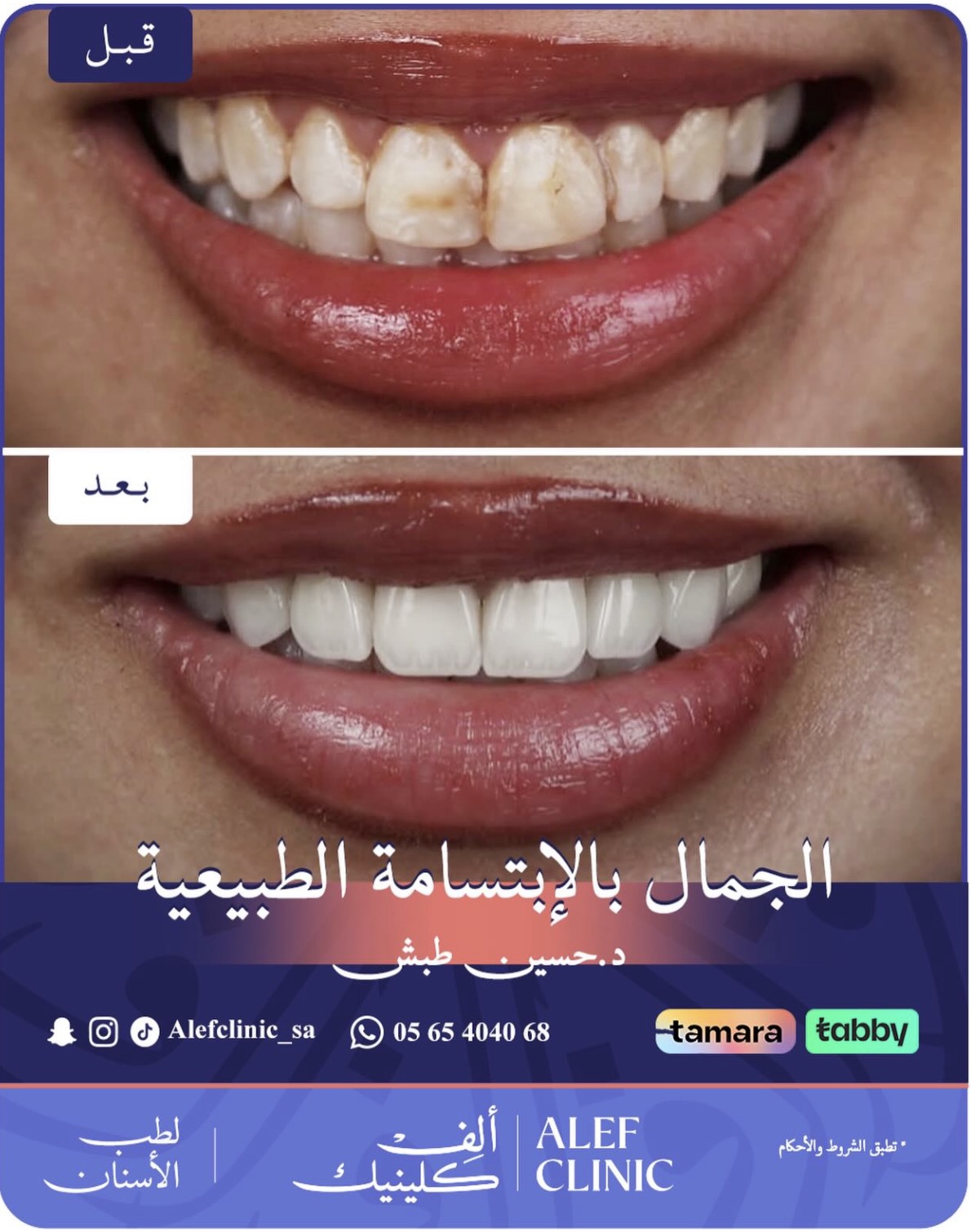 قبل وبعد