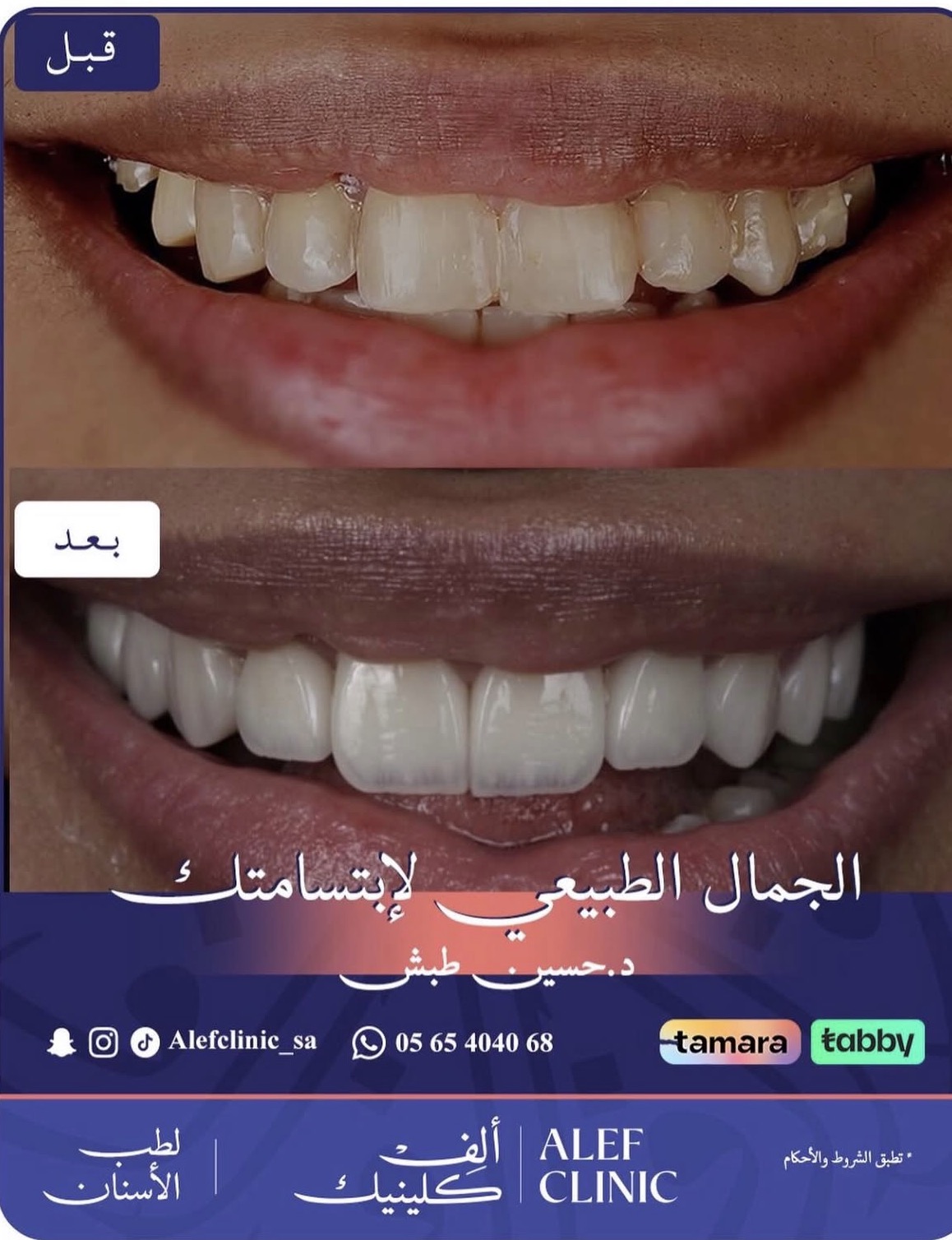 قبل وبعد
