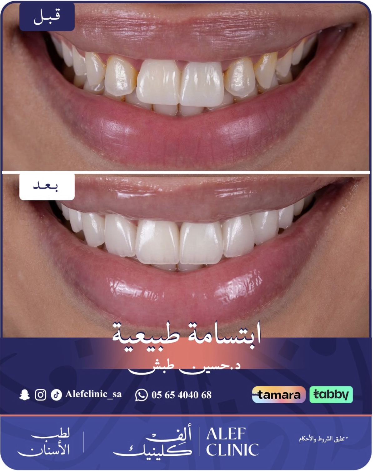 قبل وبعد