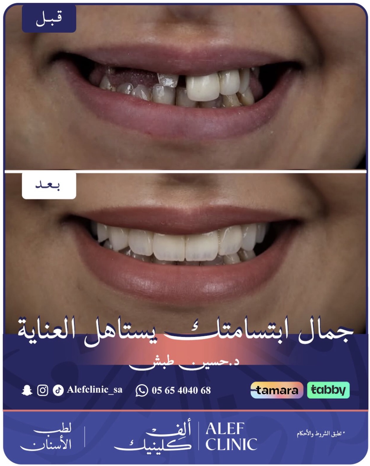 قبل وبعد