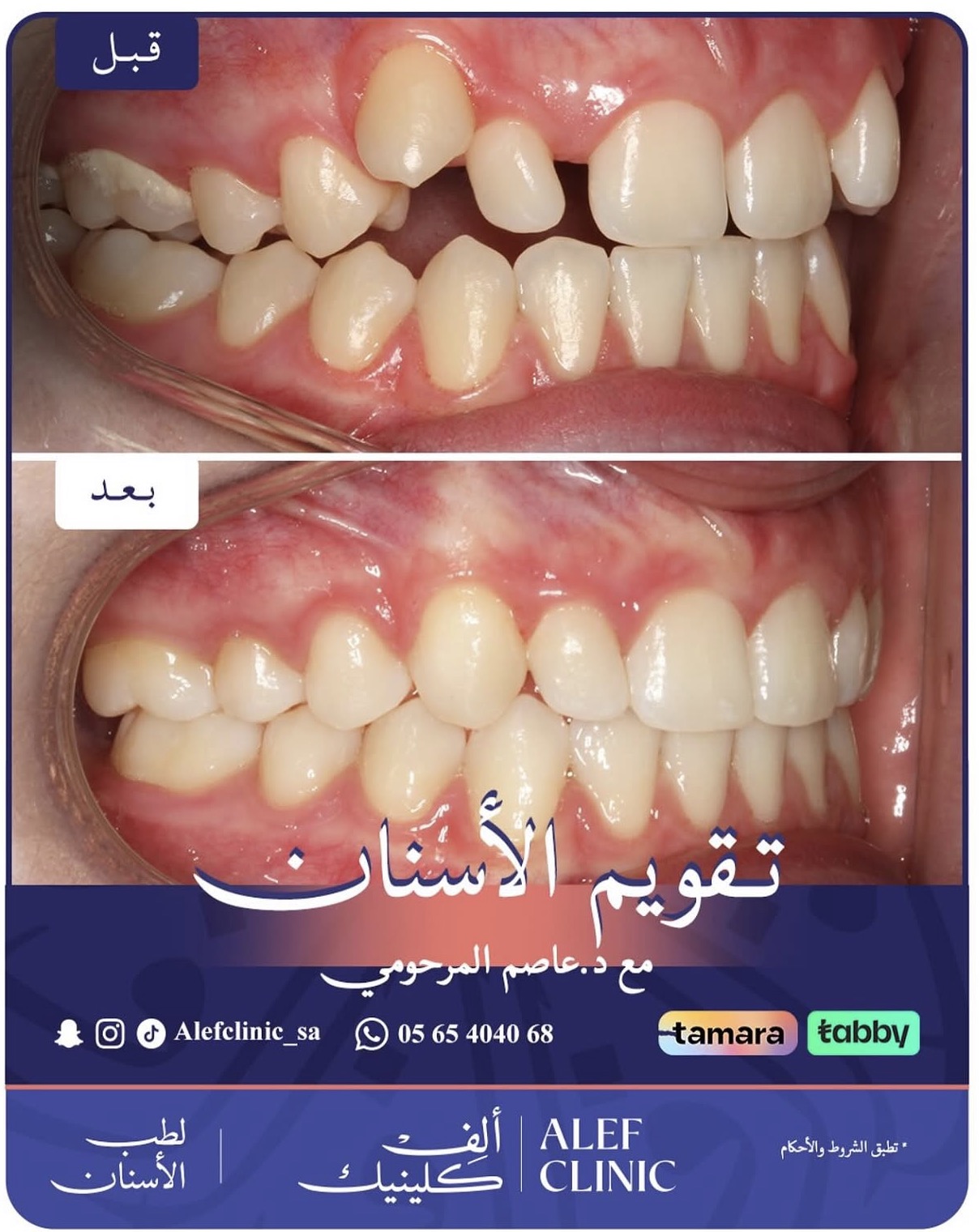 قبل وبعد