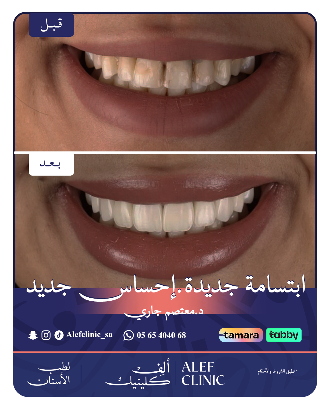 قبل وبعد